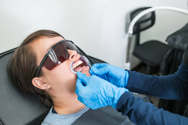 Best Emergency Wisdom Teeth Removal in Youngsville, LA